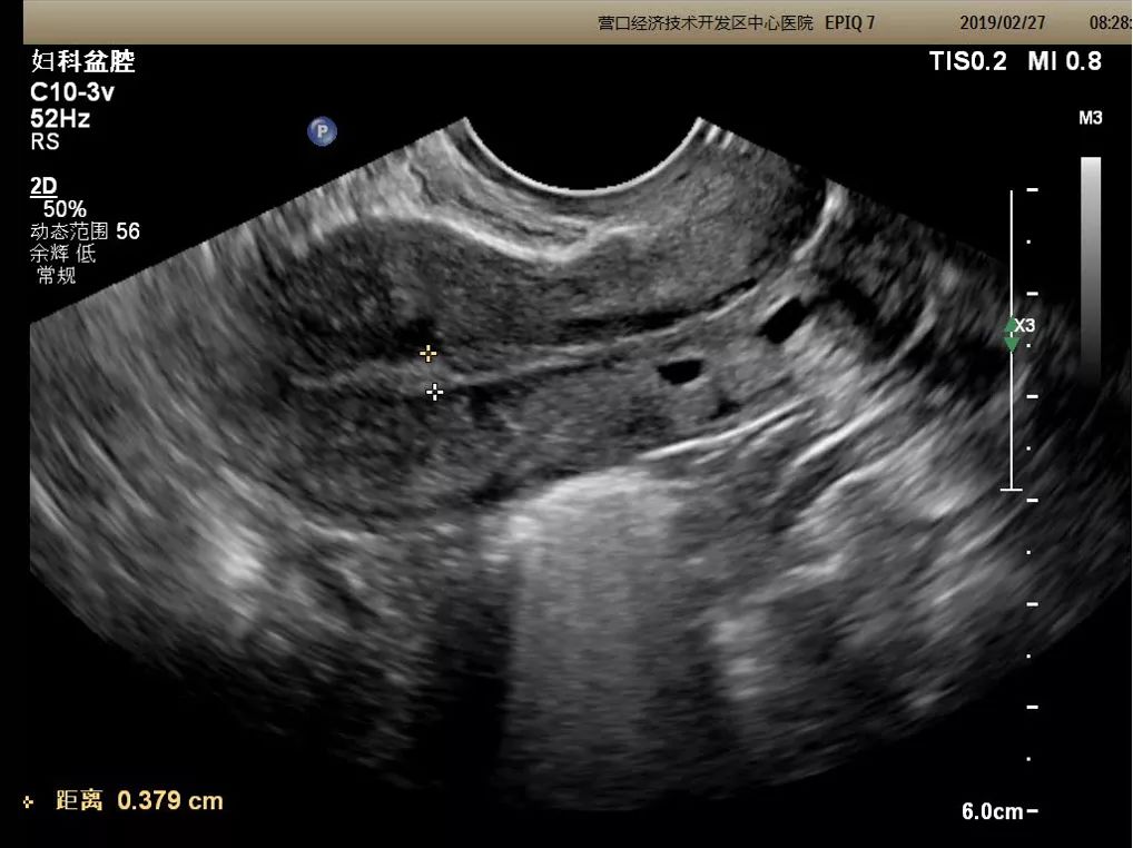 医院超声科新引进设备宣传,营口市中心医院分院彩超室