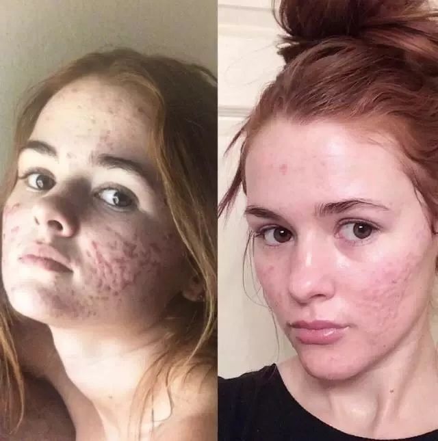 omg美妆博主,omg的美妆博主