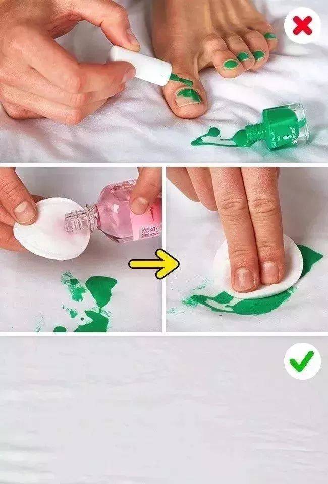 发黄的衣服要用什么方法洗如新,衣服发黄还能要吗