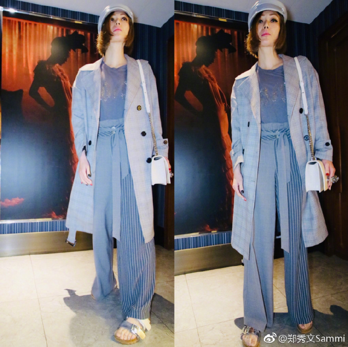 郑秀文腿伤,47岁郑秀文曝身体现状