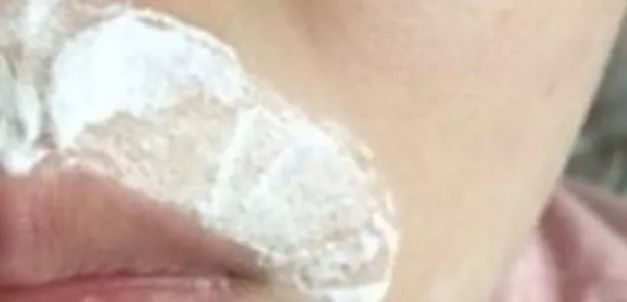 姑娘，我看你双目涣散、唇周长毛、乳晕发黑......