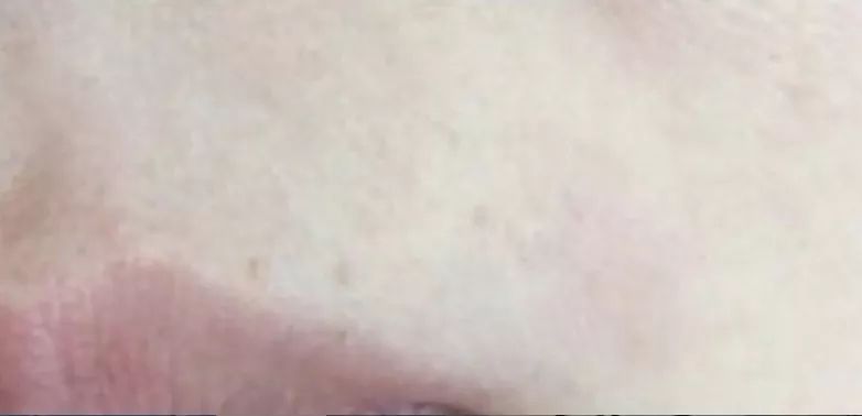 姑娘，我看你双目涣散、唇周长毛、乳晕发黑......