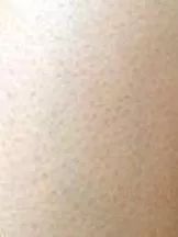 姑娘，我看你双目涣散、唇周长毛、乳晕发黑......