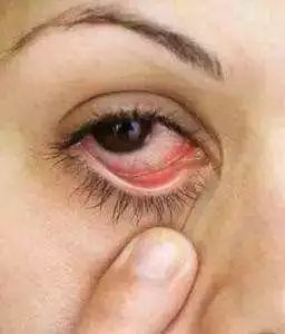 姑娘，我看你双目涣散、唇周长毛、乳晕发黑......