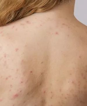 姑娘，我看你双目涣散、唇周长毛、乳晕发黑......