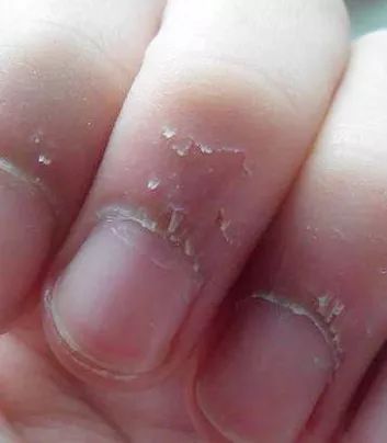 姑娘，我看你双目涣散、唇周长毛、乳晕发黑......