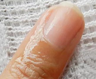 姑娘，我看你双目涣散、唇周长毛、乳晕发黑......