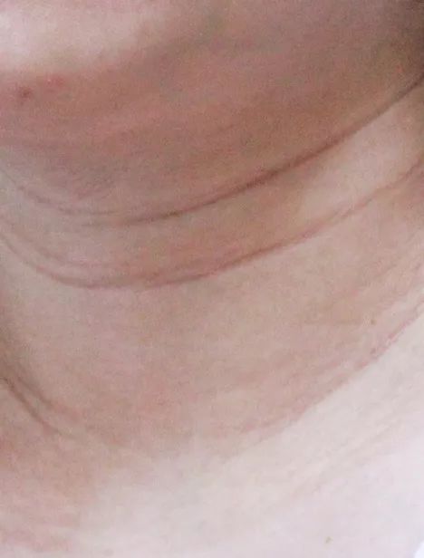 姑娘，我看你双目涣散、唇周长毛、乳晕发黑......