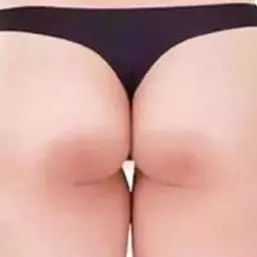 姑娘，我看你双目涣散、唇周长毛、乳晕发黑......