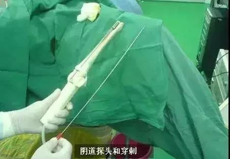 专骗年轻女性的「赌命交易」,希望永远不要发生在你身上