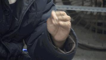 帕金森最新微创手术,帕金森病人手术治疗效果