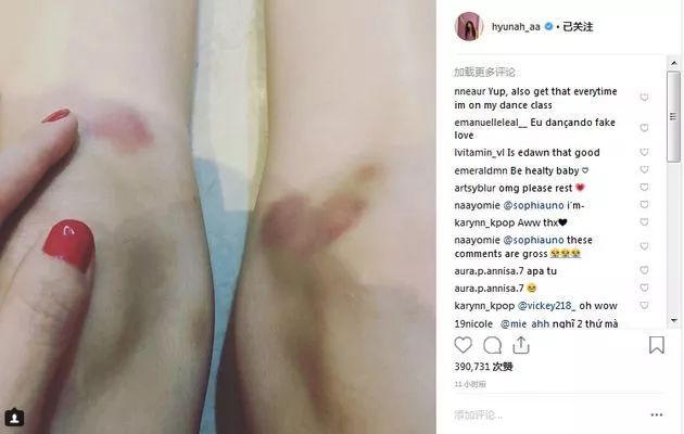 公布恋情被公司开除背假香奈儿都能带货说她是“人间毒药”我服！