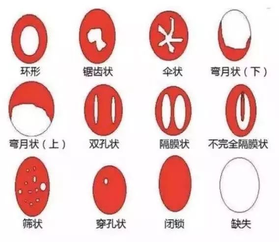大部分人都错了,大多数人错了的真相