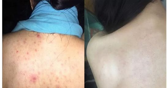 【3折抄底】身体清洁专场：进口、大牌、低至9.9包邮。喜欢干净漂亮的你～