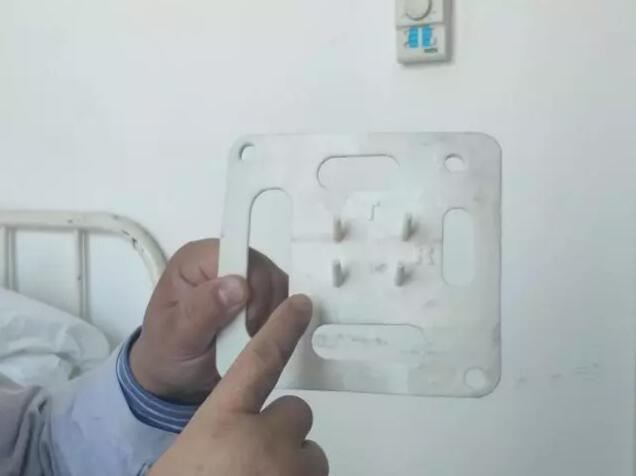 3D打印助力骶神经调节手术西安市红会医院创西北第一例