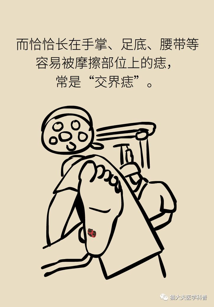 什么症状表明痣已经在恶变,先天性黑素细胞痣恶变的概率大吗