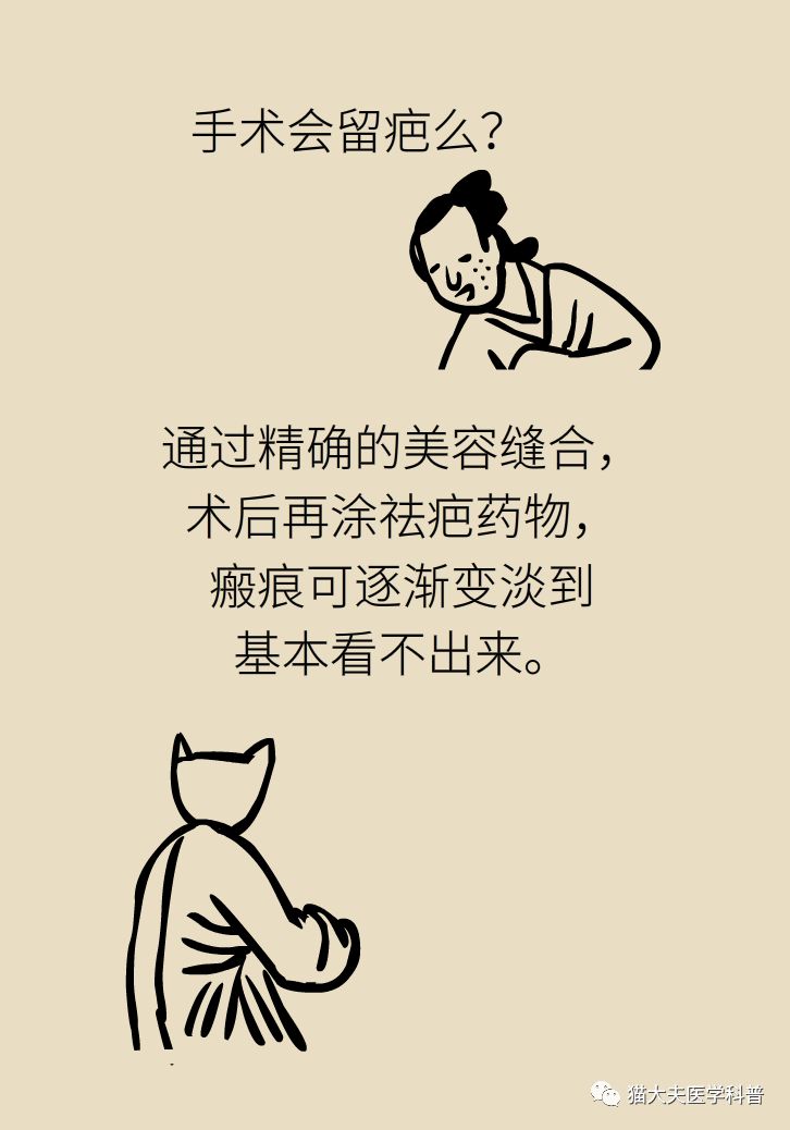 什么症状表明痣已经在恶变,先天性黑素细胞痣恶变的概率大吗