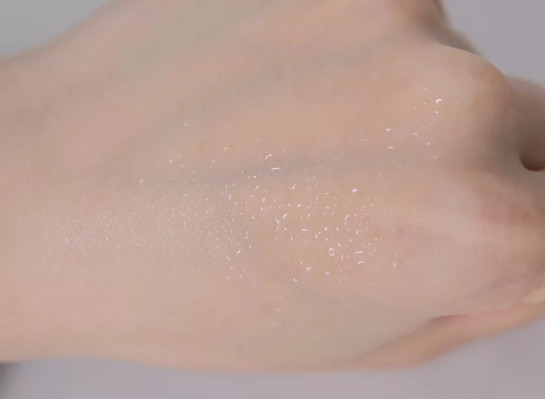 埋线双眼皮分叉修护动作,双眼皮埋线术后注意事项大全