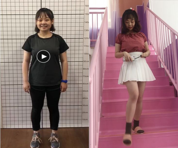 假小子变装惊艳全场的样子,肿眼泡假小子