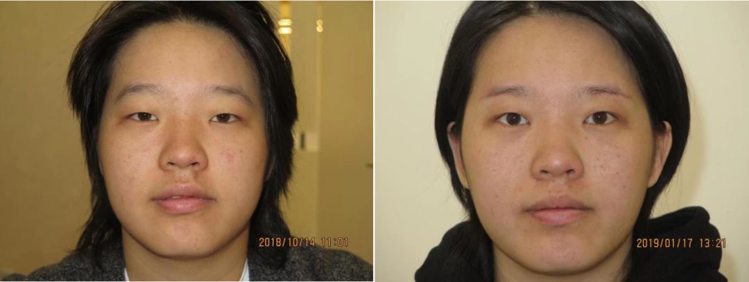 假小子变装惊艳全场的样子,肿眼泡假小子