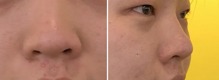 假小子变装惊艳全场的样子,肿眼泡假小子