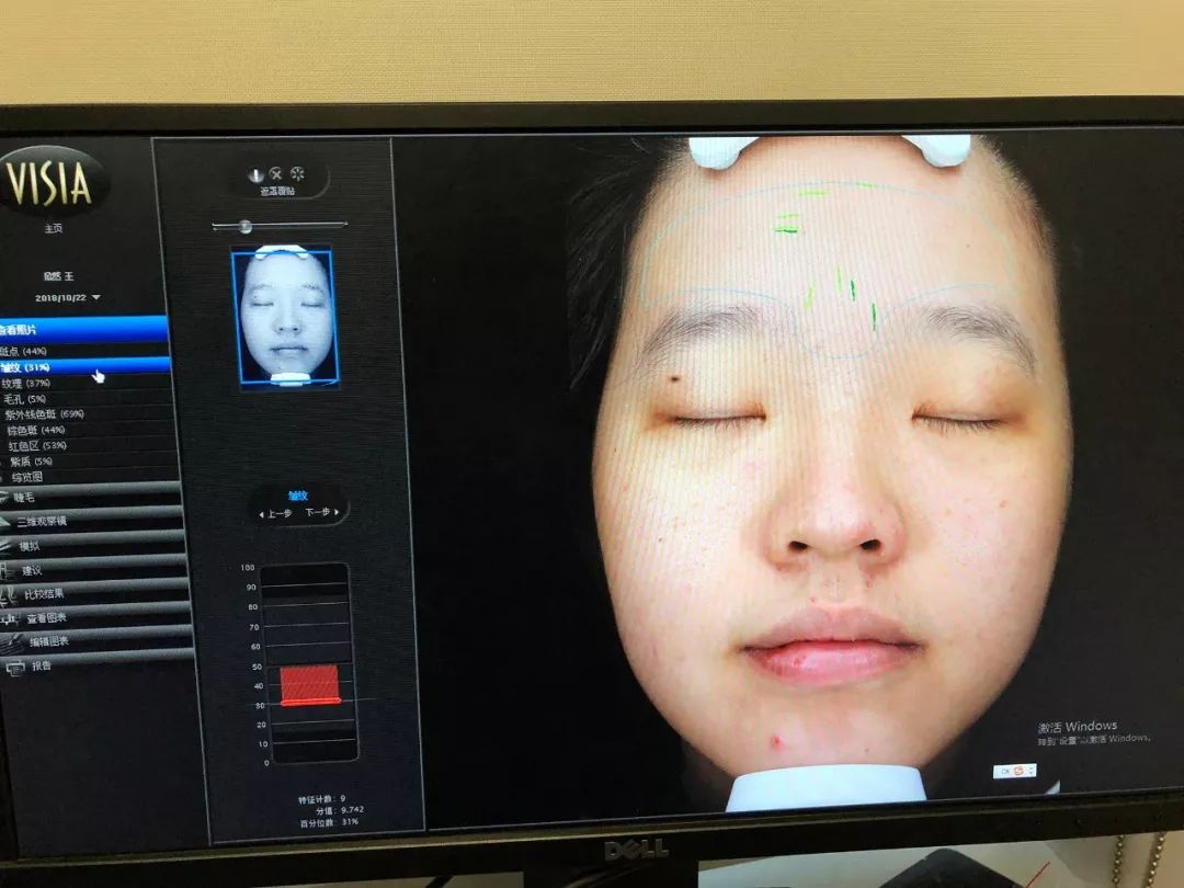 假小子变装惊艳全场的样子,肿眼泡假小子