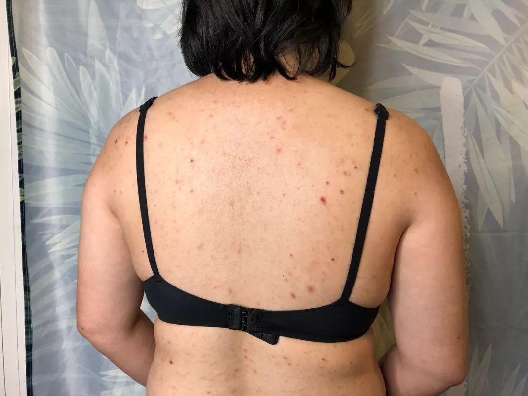 假小子变装惊艳全场的样子,肿眼泡假小子