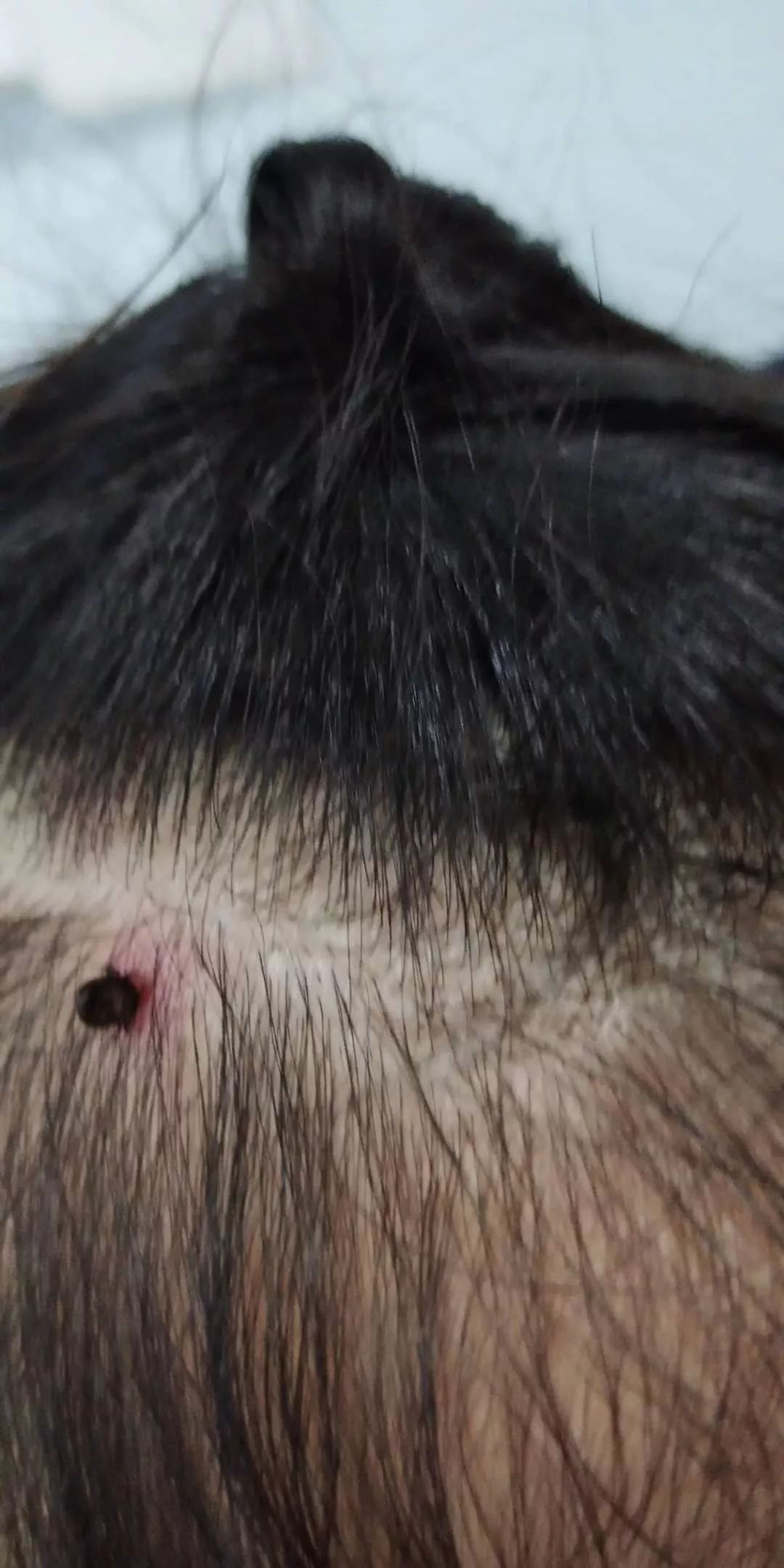 3岁女童头痒是什么原因,三岁孩子头皮有黄色结痂