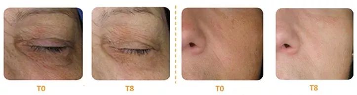 皮肤暗黄色素沉淀多吃什么,容易暗沉皮肤忌口