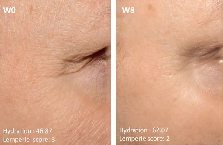 皮肤暗黄色素沉淀多吃什么,容易暗沉皮肤忌口