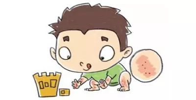 春风过敏是什么原因,春风脸上过敏