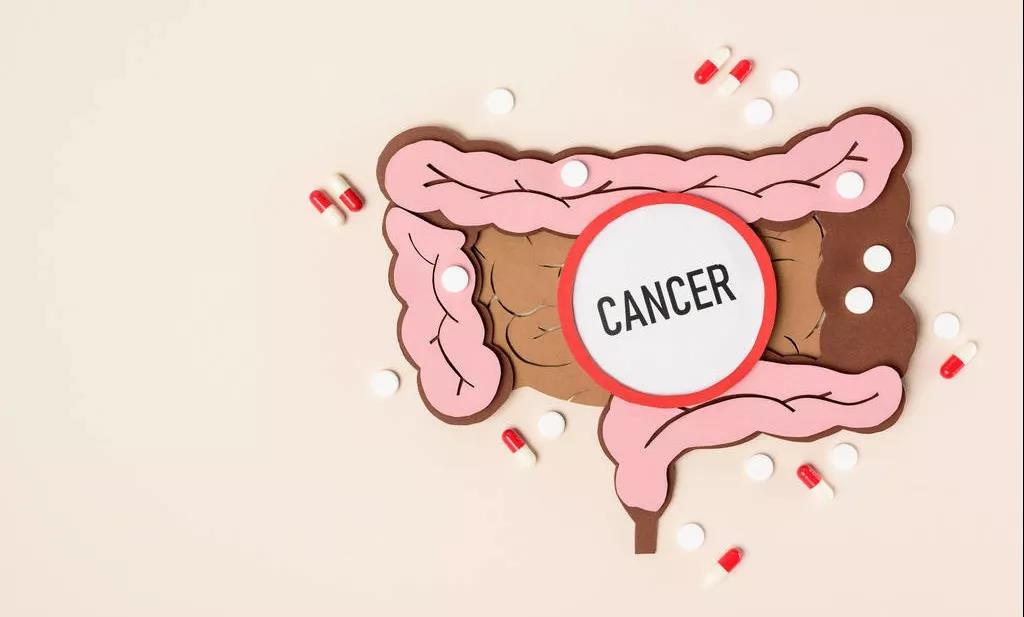 为什么切了息肉，还是会患癌？因为切息肉有时就像割韭菜……