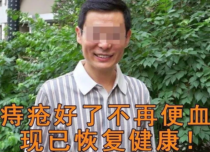 80%的痔疮无需手术治疗吗,痔疮又犯了用这个方法轻松治痔疮