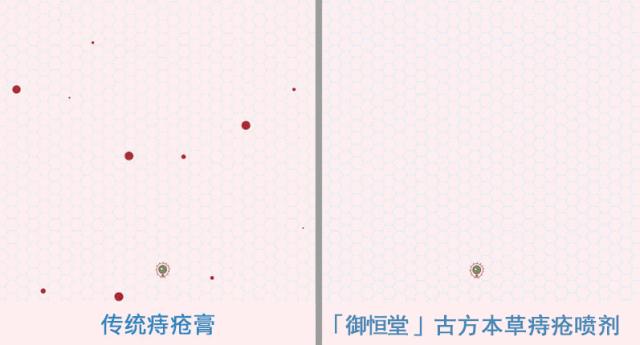 80%的痔疮无需手术治疗吗,痔疮又犯了用这个方法轻松治痔疮