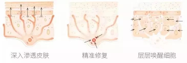 80%的痔疮无需手术治疗吗,痔疮又犯了用这个方法轻松治痔疮