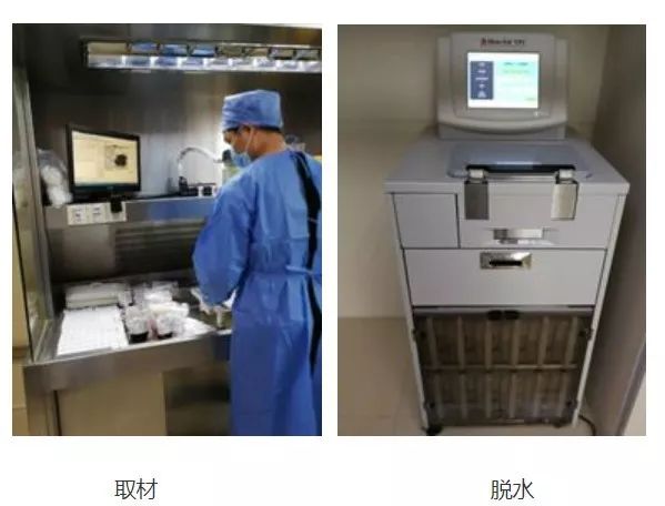 病理结果有可能二十天都没结果吗,病理结果3天就出了会是恶性吗