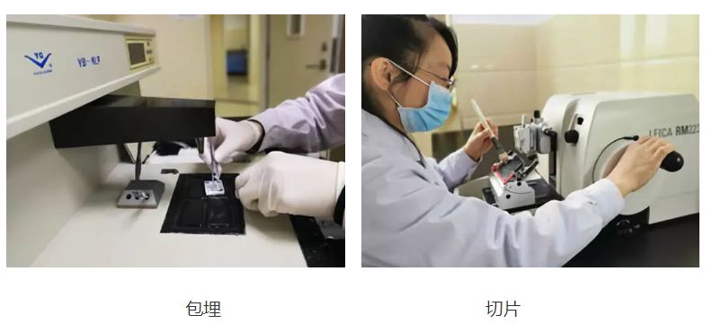 病理结果有可能二十天都没结果吗,病理结果3天就出了会是恶性吗