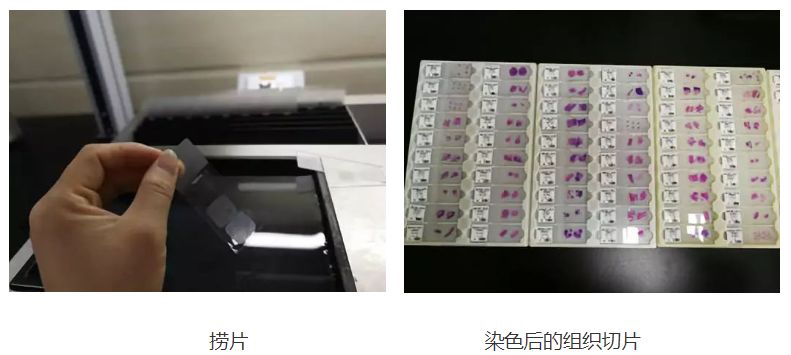 病理结果有可能二十天都没结果吗,病理结果3天就出了会是恶性吗
