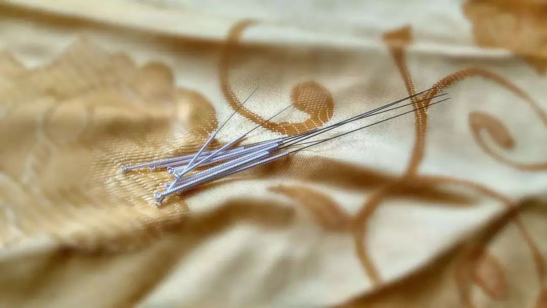 针灸可以用于麻醉，你知道吗？——写在针刺麻醉发展60余年