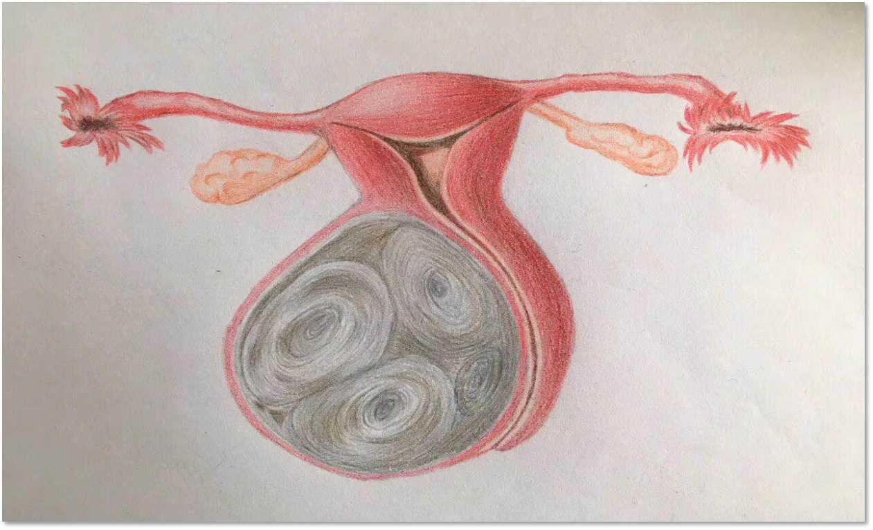 浙江省肿瘤医院优势,浙江肿瘤医院新进展