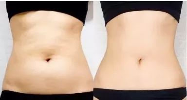 不用节食也可以暴瘦身体,不用节食还能瘦的神器