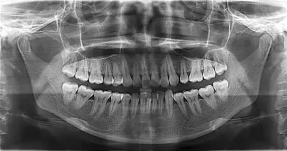 不到1折疯抢！全家口腔健康有保证~29.9元抢购原价895元劲松牙科家庭口腔护理套餐！超声波洁牙+中老年口腔护理+儿童口腔护理…