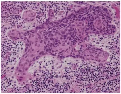 直到看了病理医生切的片子,我才明白了什么叫「艺术细胞」