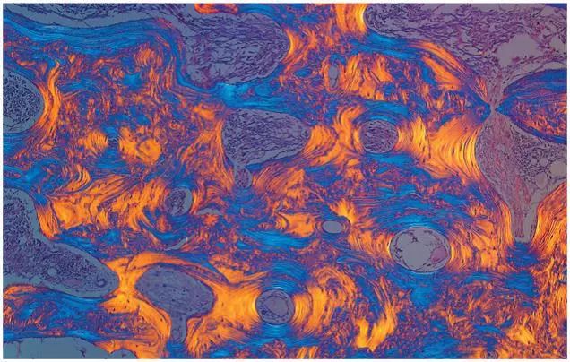 直到看了病理医生切的片子,我才明白了什么叫「艺术细胞」