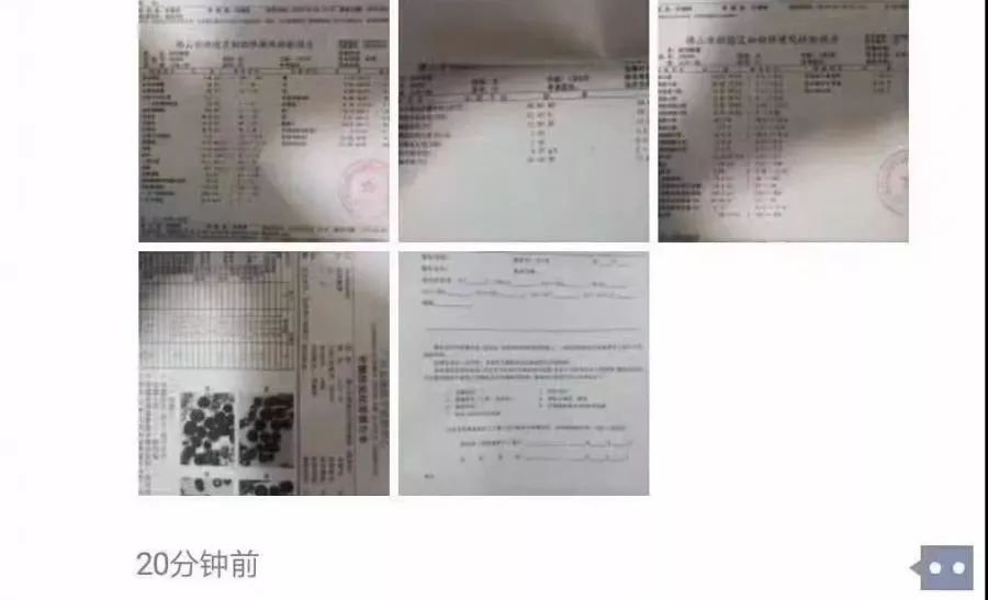 熊猫血患者急需输血,16岁女孩急需“熊猫血”