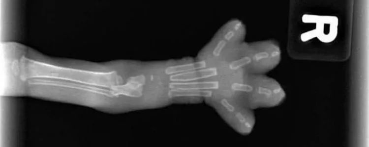 21岁熊猫血女大学生被强制献血,女子熊猫血多次被劝献血