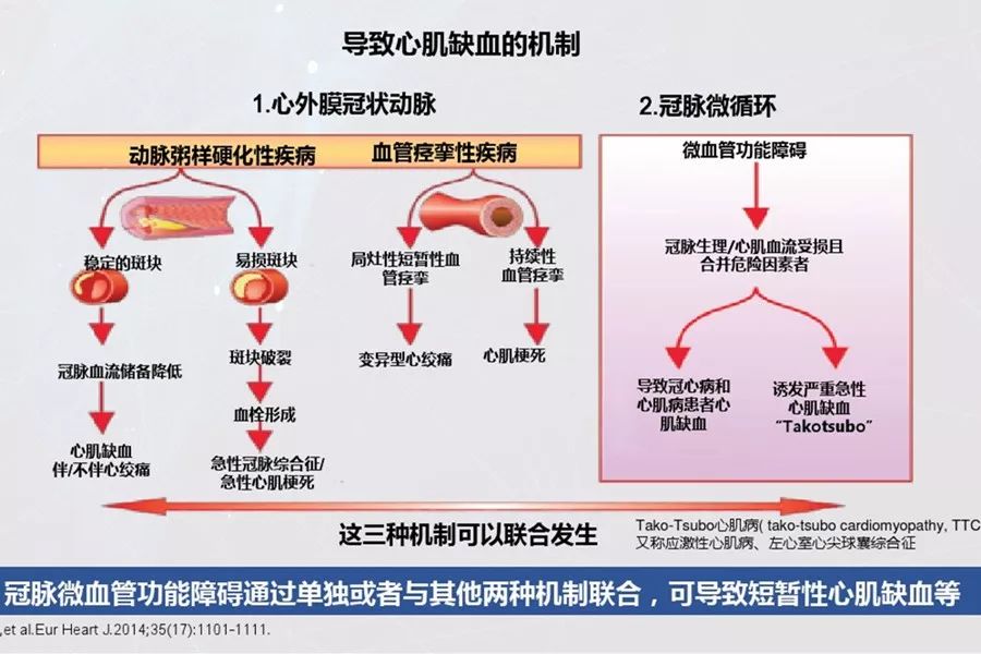冠状动脉微血管病变治疗指南,谢萍医生好不好