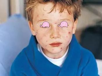 儿童常见皮疹及处理方法,儿童春季高发皮肤病