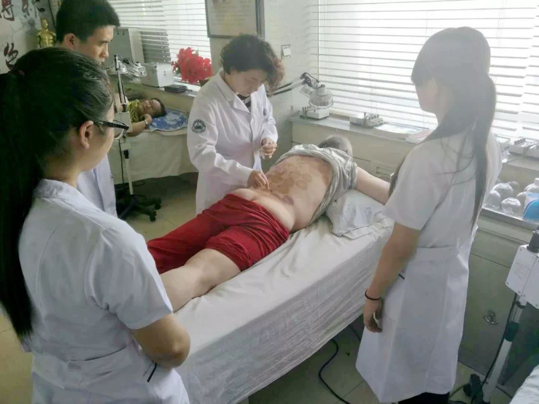 带状疱疹中医辨证及方剂,中医治疗带状疱疹的方剂