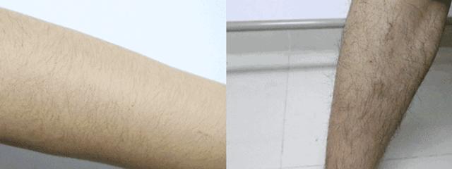 ⊙超管用！不用刮、零疼痛，轻轻一抹就能「快速脱毛」